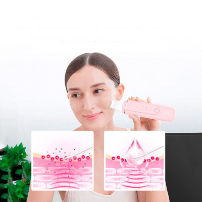 Аппарат для чистки лица InFace Blackhead Remover MS7100 розовый-2